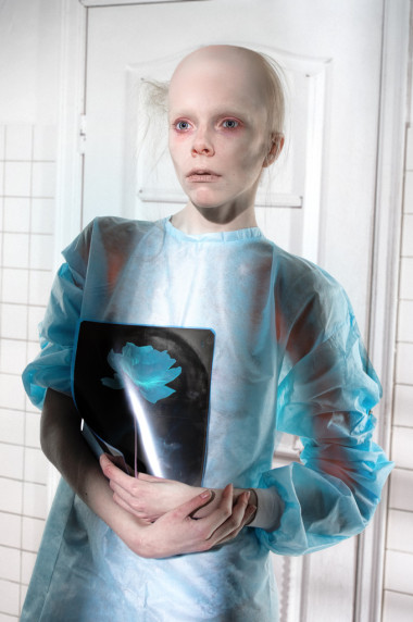 在醫(yī)院里病禿頭女人