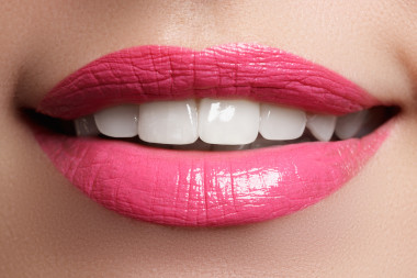 Perfect smile after bleaching. Dental care and whitening teeth. Woman smile with great teeth. Close-up of smile with whi