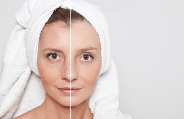 美概念-护肤、 抗衰老程序、 复兴