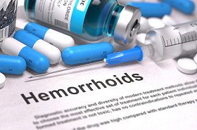 Diagnosis - Hemorrhoid Medical concept 3D rendering