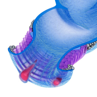 痔疮: 肛门疾病、 x 射线视图