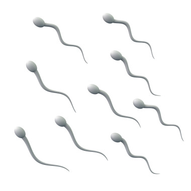 組的 spermatozoons，精子
