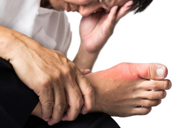 大腳趾周圍他腳上的疼痛和發(fā)炎痛風(fēng)的人.