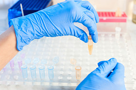 实验室微量移液器在离心滴生物的解决方案