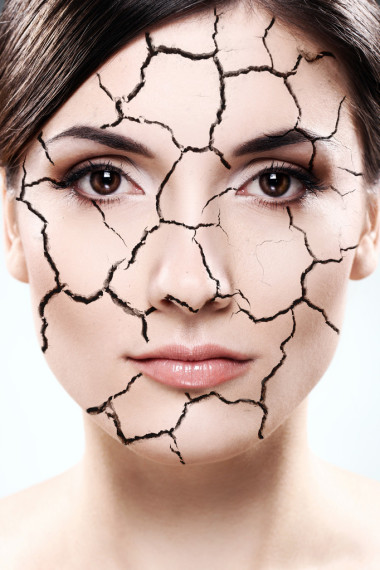 女人肖像-干的皮肤的概念照片