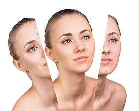 美容概念之前和之后的对比