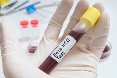 血液为 Beta hcg 测试管在手动测试.