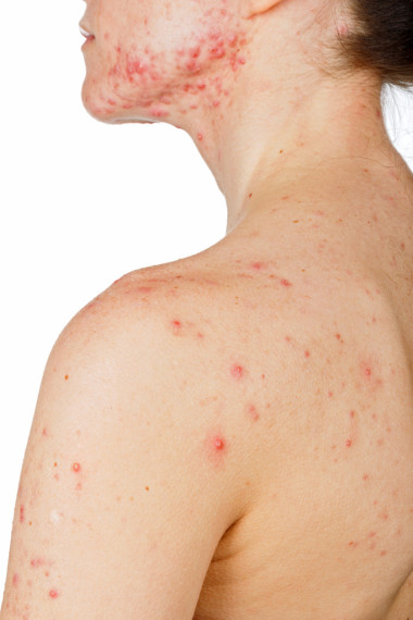 年轻女孩皮肤问题图片