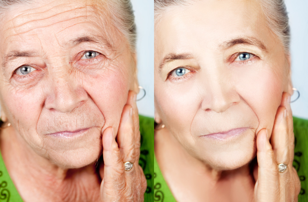 Beauty and skin care concepts -- no aging wrinkles Beauty and skin care concepts -- no aging wrinkles