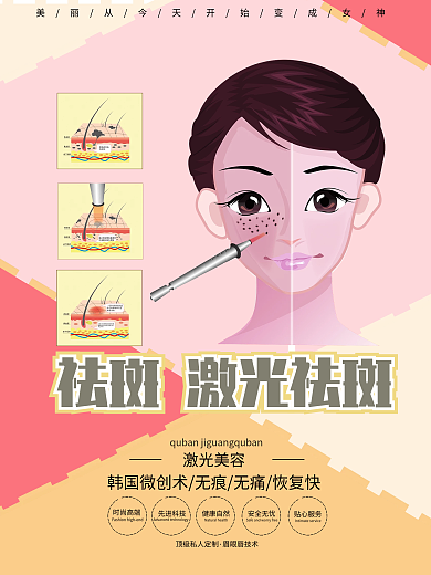 简约祛斑祛斑美容宣传海报