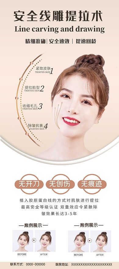 医疗美容安全线雕术浅黄色简约风宣传展架