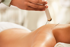 中医艾灸与针灸