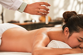 年轻女子接受针灸艾灸治疗图片