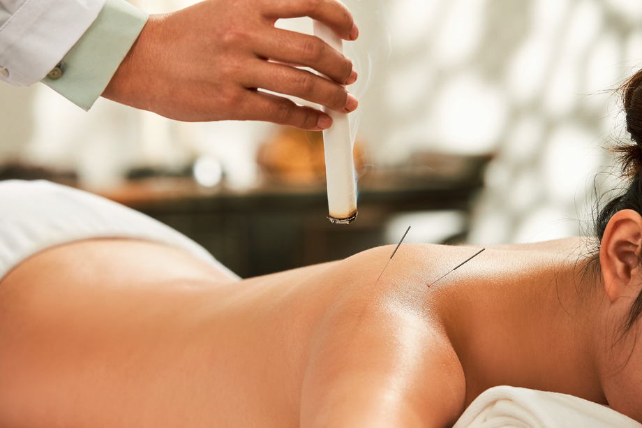 中医艾灸与针灸 中医艾灸与针灸