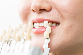 青年女人牙齿美容