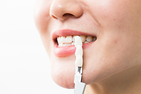 青年女人牙齿美容