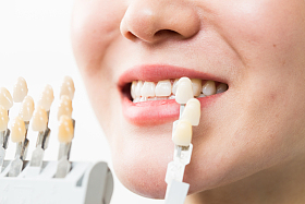 青年女人牙齿美容