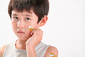 脸上受伤的小男孩图片